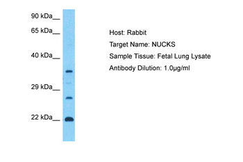 NUCKS1 Rabbit Polyclonal Antibody