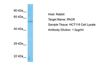 ADCYAP1R1 Rabbit Polyclonal Antibody