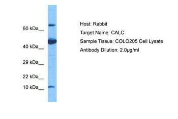 CALCA Rabbit Polyclonal Antibody
