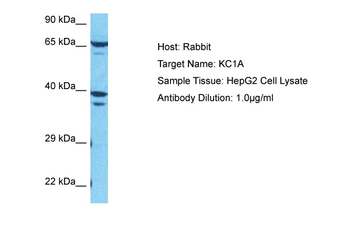 CSNK1A1 Rabbit Polyclonal Antibody