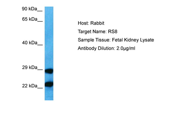 RPS8 Rabbit Polyclonal Antibody