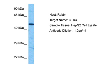 SLC2A3 Rabbit Polyclonal Antibody
