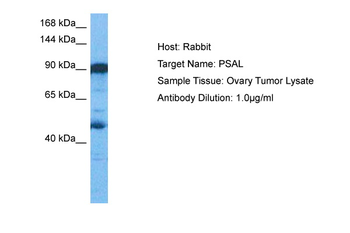 NPEPPS Rabbit Polyclonal Antibody