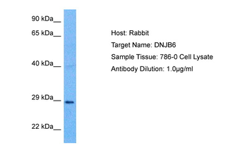 DNAJB6 Rabbit Polyclonal Antibody