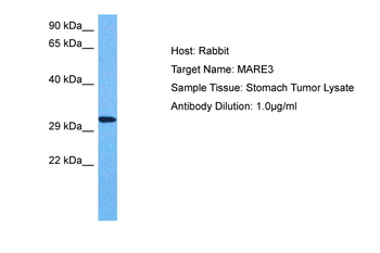 MAPRE3 Rabbit Polyclonal Antibody