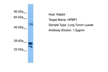 HSPBP1 Rabbit Polyclonal Antibody