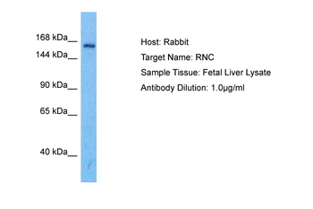 DROSHA Rabbit Polyclonal Antibody