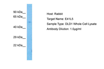 EPB41L5 Rabbit Polyclonal Antibody