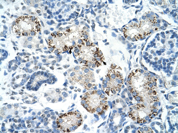 PDCD8 Rabbit Polyclonal Antibody