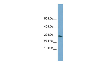 H3F3A (Phospho-Histone H3) Rabbit Polyclonal Antibody