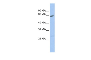PCTK1 Rabbit Polyclonal Antibody