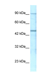 GABRP Rabbit Polyclonal Antibody