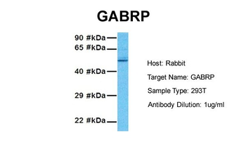 GABRP Rabbit Polyclonal Antibody