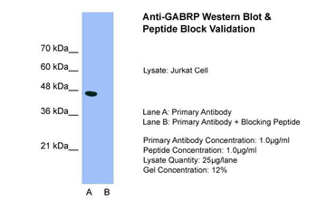 GABRP Rabbit Polyclonal Antibody