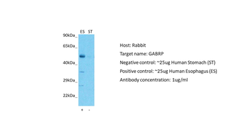 GABRP Rabbit Polyclonal Antibody