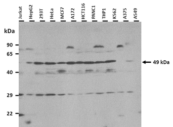 GCM1 Rabbit Polyclonal Antibody
