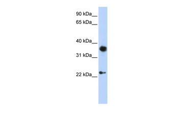 EN1 Rabbit Polyclonal Antibody