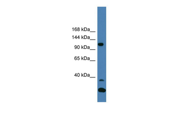 TYK2 Rabbit Polyclonal Antibody