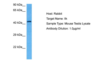ILK Rabbit Polyclonal Antibody