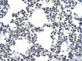 CRKL Rabbit Polyclonal Antibody