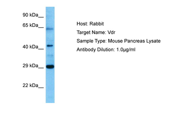 VDR Rabbit Polyclonal Antibody