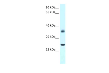 Jund Rabbit Polyclonal Antibody