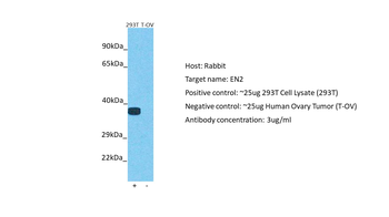 EN2 Rabbit Polyclonal Antibody