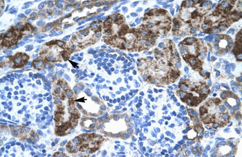 EN2 Rabbit Polyclonal Antibody