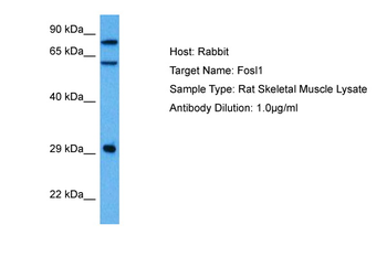 FOSL1 Rabbit Polyclonal Antibody