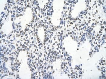 FOSL1 Rabbit Polyclonal Antibody