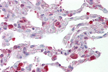 FOSL1 Rabbit Polyclonal Antibody