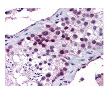 HOXA5 Rabbit Polyclonal Antibody