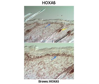 HOXA5 Rabbit Polyclonal Antibody