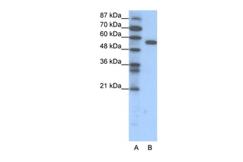 FOXC2 Rabbit Polyclonal Antibody