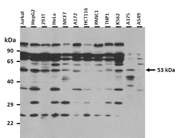 HNF4A Rabbit Polyclonal Antibody