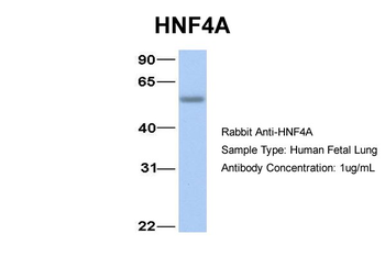 HNF4A Rabbit Polyclonal Antibody