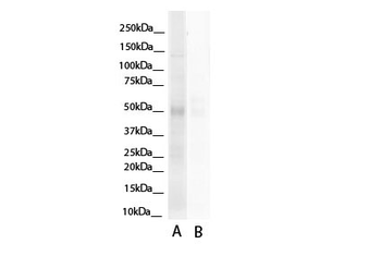HNF4A Rabbit Polyclonal Antibody