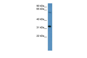 Hoxd13 Rabbit Polyclonal Antibody