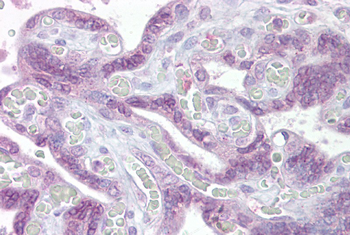 IRF6 Rabbit Polyclonal Antibody