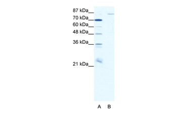 MEFV Rabbit Polyclonal Antibody
