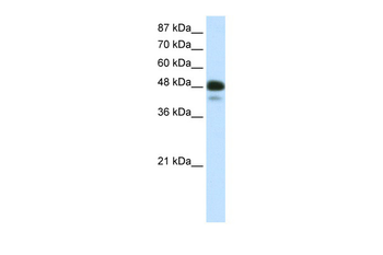 NEUROD2 Rabbit Polyclonal Antibody