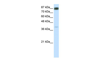 NFATC4 Rabbit Polyclonal Antibody