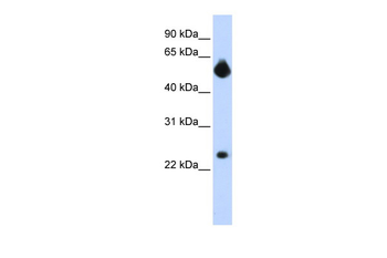 NOTCH4 Rabbit Polyclonal Antibody
