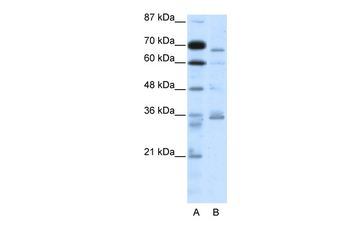 PCSK6 Rabbit Polyclonal Antibody