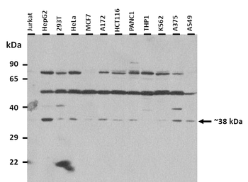PAX4 Rabbit Polyclonal Antibody