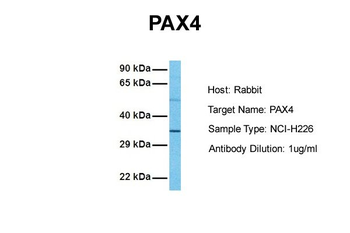 PAX4 Rabbit Polyclonal Antibody