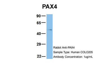 PAX4 Rabbit Polyclonal Antibody