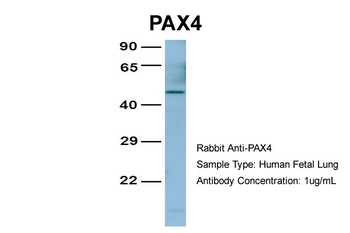 PAX4 Rabbit Polyclonal Antibody