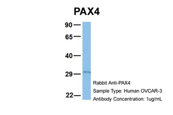 PAX4 Rabbit Polyclonal Antibody
