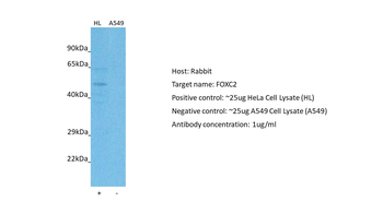 FOXC2 Rabbit Polyclonal Antibody